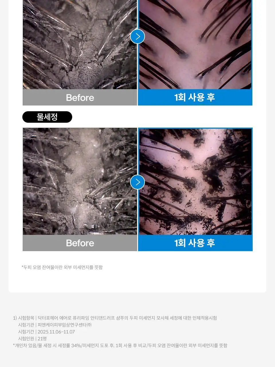 [비듬샴푸 단독기획] 닥터포헤어 에어로 퓨리파잉 안티댄드러프 비듬샴푸 400ml 기획 (+70ml) 상세페이지 14